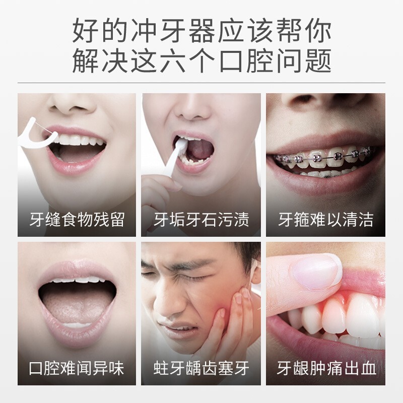 拜尔（BAIR） M3电动冲牙器家用便携式 清洁口腔洗牙器水牙线冲洗器洁牙器牙套清洗M3Plus